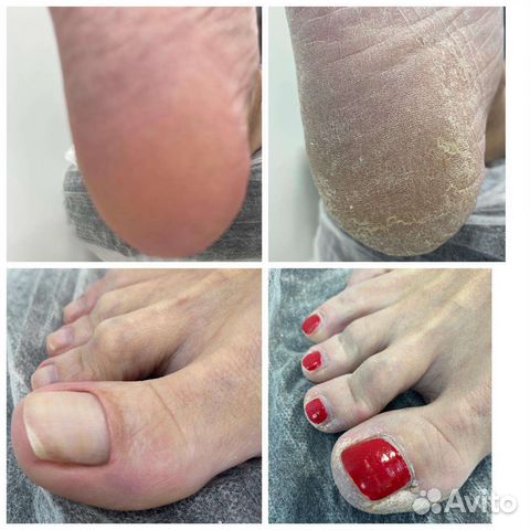 Подолог Педикюр мужской и женский